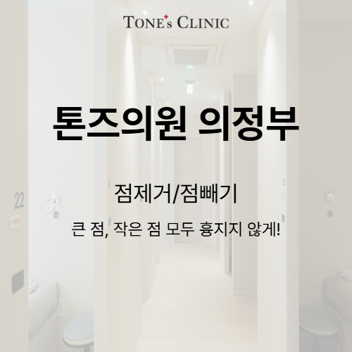 점빼기