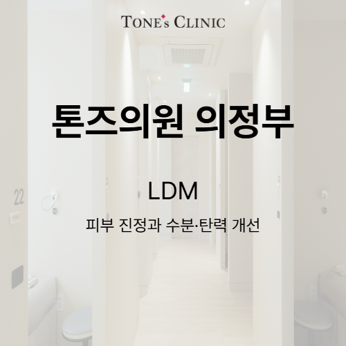 LDM