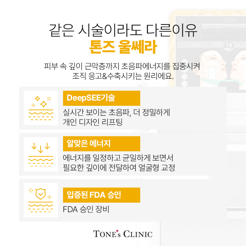 같은 시술이라도 다른이유 톤즈 울쎄라
