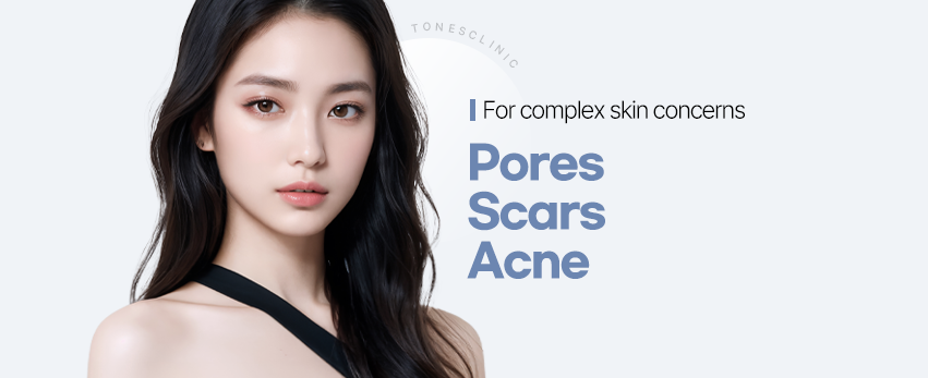 Pores_Acne_Scars