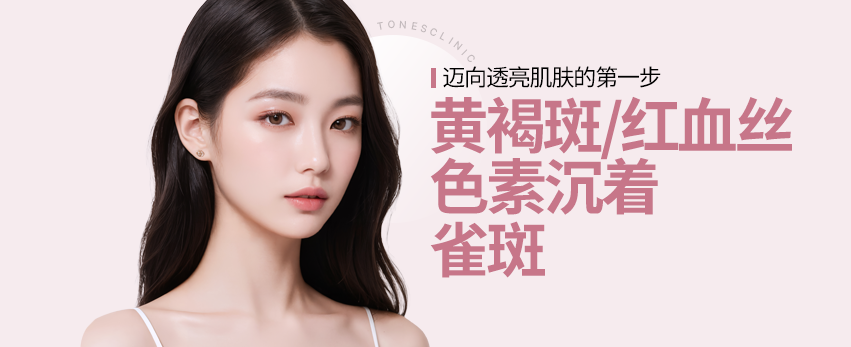 黄褐斑 红血丝 色素沉着 雀斑