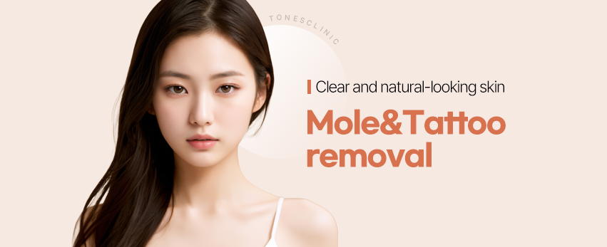 Mole Removal / Tattoo Removal