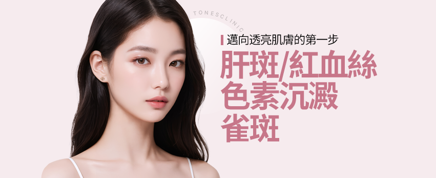 皮肤激光