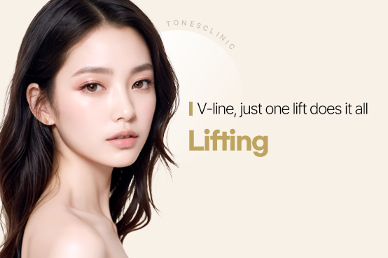 Lifting
