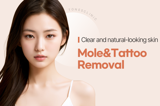Mole Removal/Tattoo Removal
