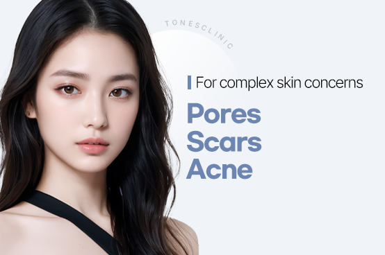 Pores/Scars/Acne