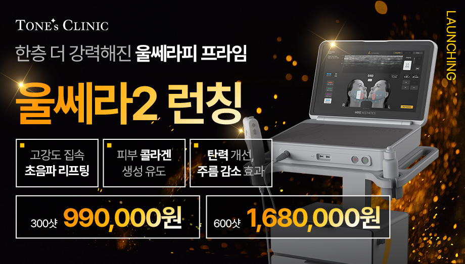 팝업