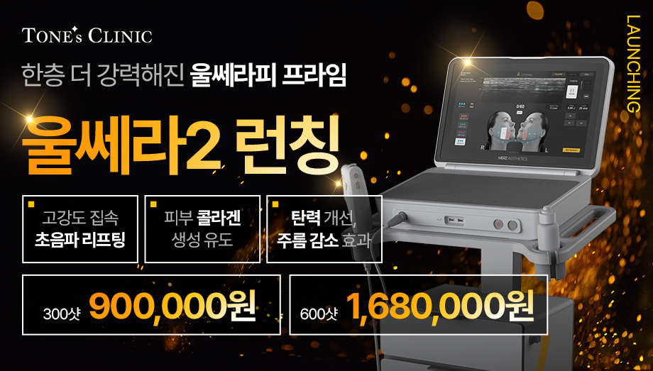 팝업