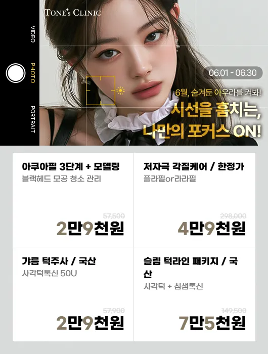 팝업