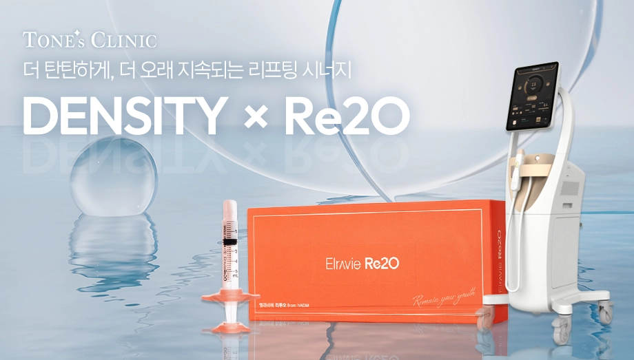 팝업