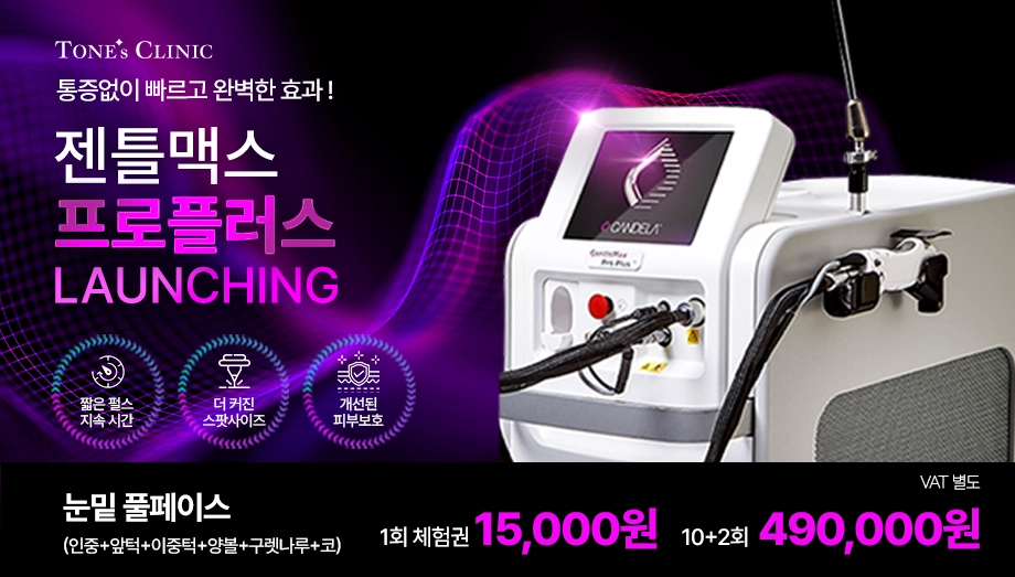 팝업